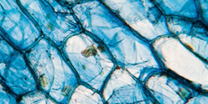 Close-up of blue, scale-like structures with transparent and intertwined patterns. Close-up of blue, scale-like structures with transparent and intertwined patterns.