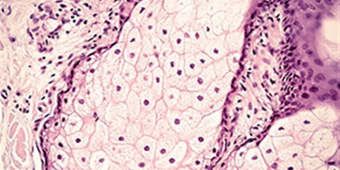 Microscopic view of skin tissue with cells arranged in various layers. Microscopic view of skin tissue with cells arranged in various layers.